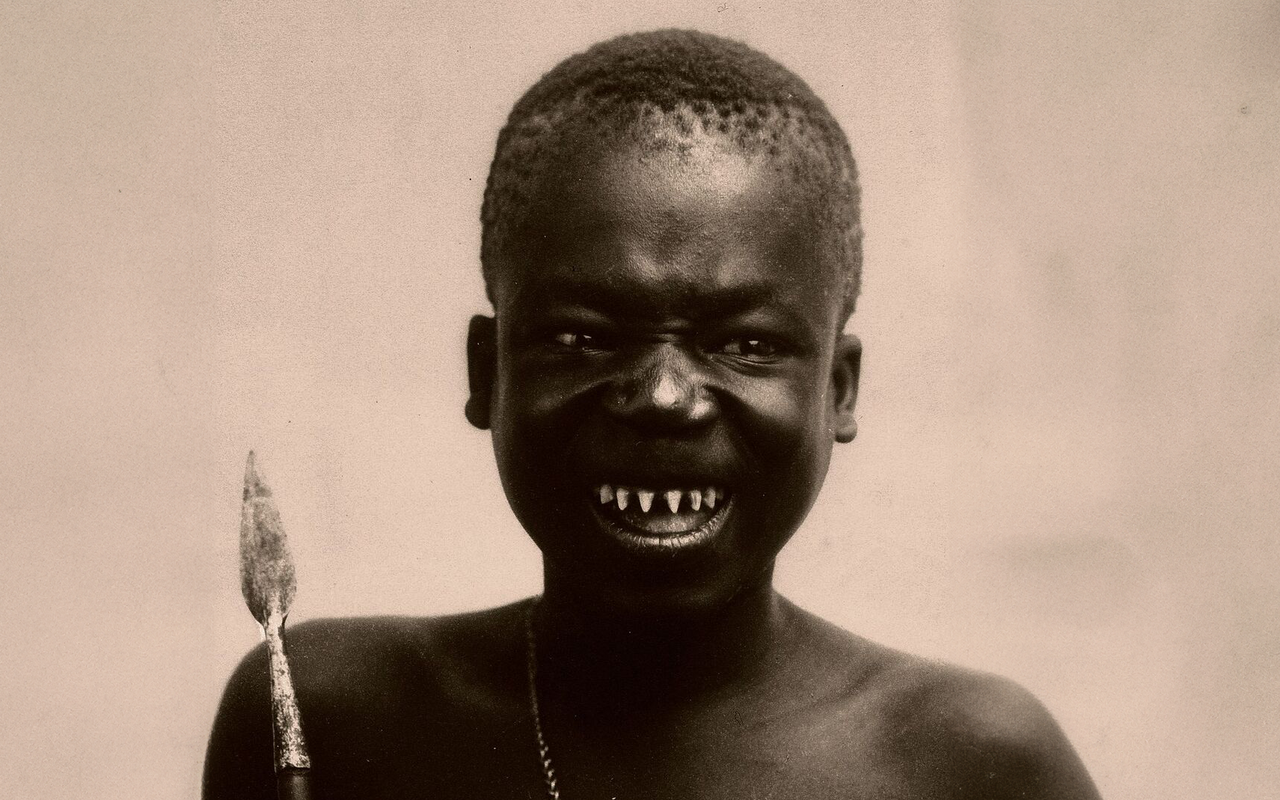 Besonders beliebt bei Völkerschauen waren Menschen mit Körper-modifizierungen wie angefeilten Zähnen oder Lippentellern.